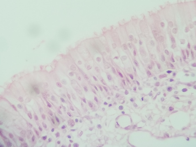 Pseudostratified Epithelium Slides - Pseudostratified Epithelium 08 400X